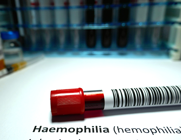 haemophilia summary.jpg